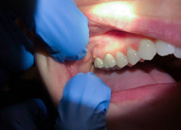 Best Emergency Cosmetic Dentistry in Oakville, MO