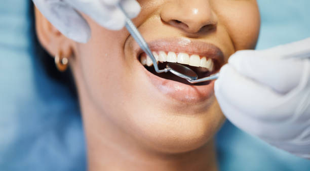 Best Weekend Emergency Dentist in Oakville, MO