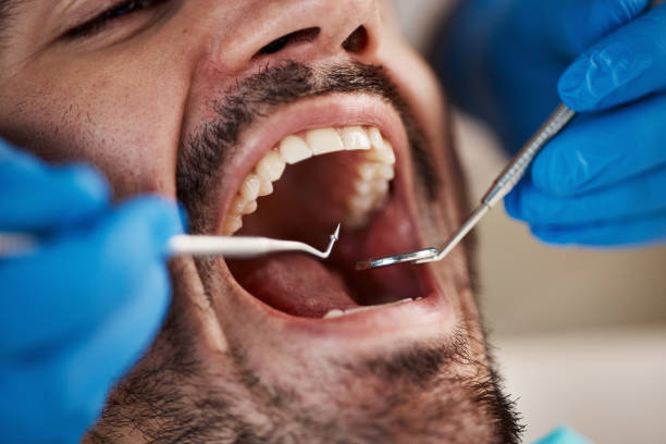 Best Pediatric Emergency Dentist in Oakville, MO
