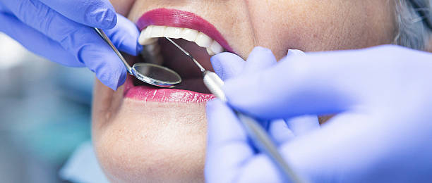 Best Broken or Cracked Tooth Emergency Dentist in Oakville, MO